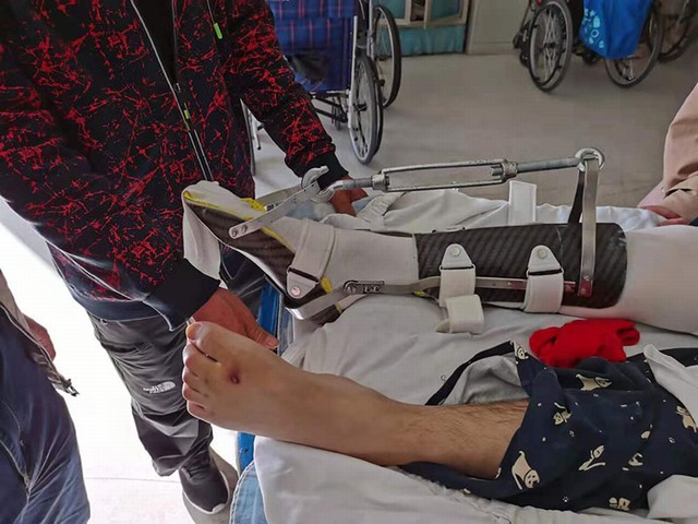 跟腱萎缩磨炼支具