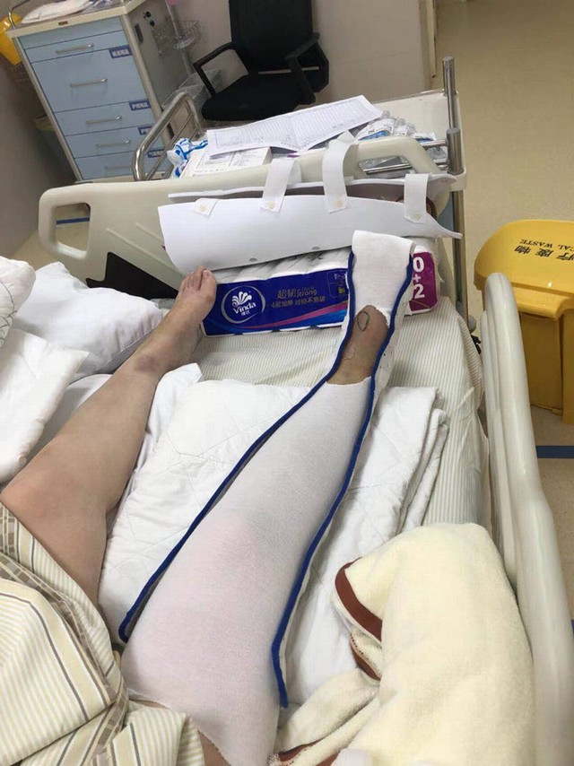 膝踝足低温
